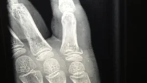 DEHANNE Héléne, Infirmière libérale à Aulnoye-Aymeries