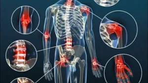 Centre de Soins Aubagne (sur RDV uniquement) perfusions « pieuvre » et injections sous-cutanées à Aubagne